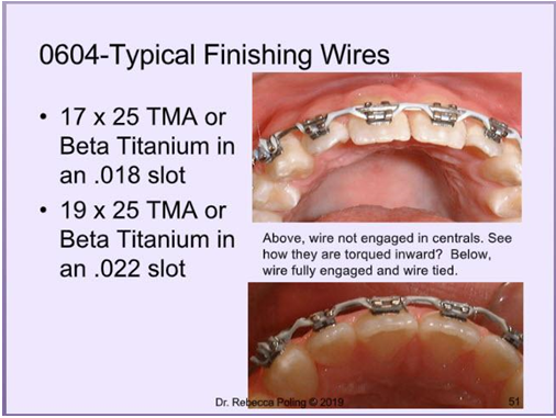 Wire Assistant Guide 60.00-Orthodontic Assistant 60-Day In-Office Training Program - Product ...